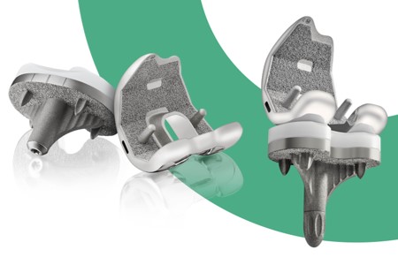 UNITED U2 PF+ Knee System / United Orthopedic Corporation