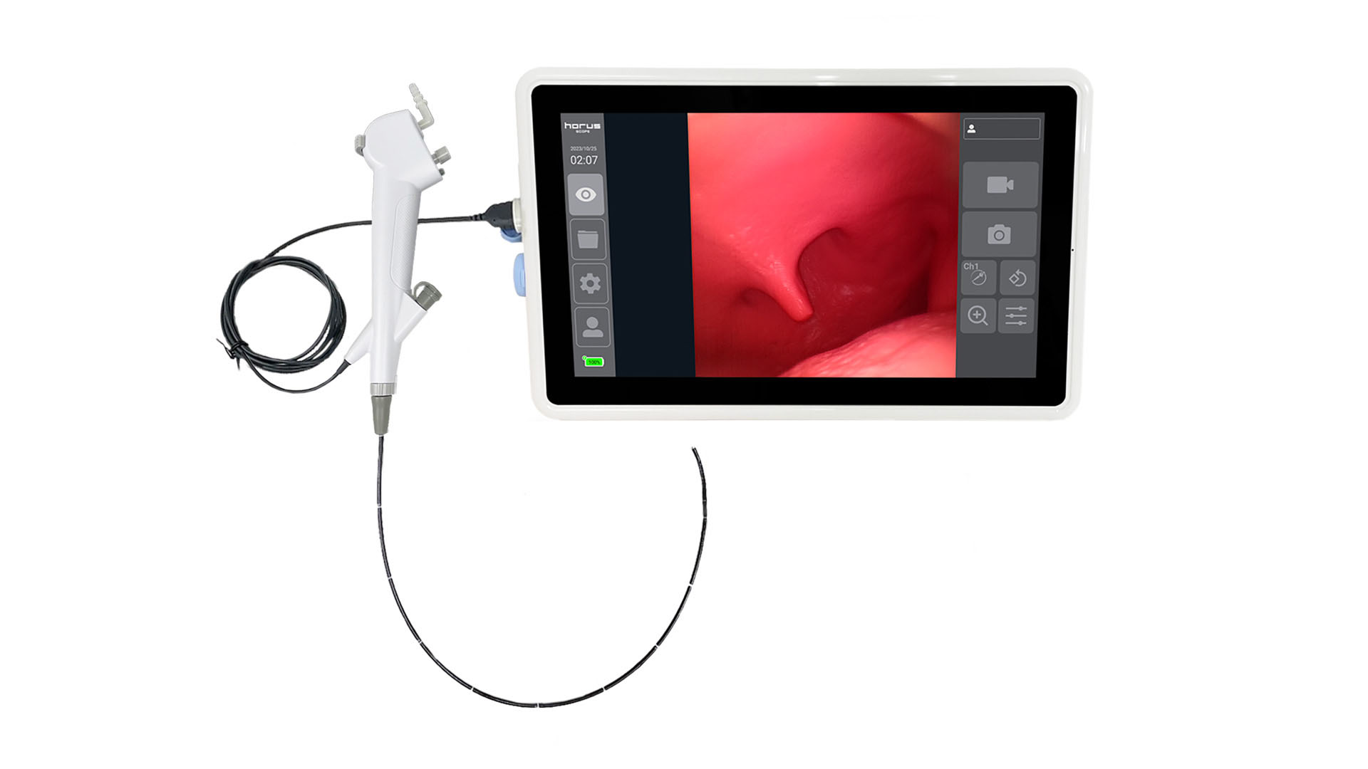 Horus Bronchoscope